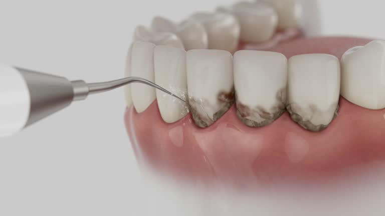 Reliable Emergency Dentist contractor in Boone, NC by Smile Center Dentistry